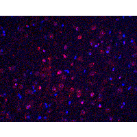 BTK Antibody - Immunofluorescence of BTK in mouse brain tissue with BTK antibody at 20 µg/ml.Red: BTK Antibody  Blue: DAPI staining