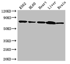 BTK Antibody - Positive WB detected in:K562 whole cell lysate,HL60 whole cell lysate,Mouse heart tissue,Mouse liver tissue,Mouse brain tissue;All lanes: BTK antibody at 3.5ug/ml;Secondary;Goat polyclonal to rabbit IgG at 1/50000 dilution;Predicted band size: 77,80 kDa;Observed band size: 77 kDa;