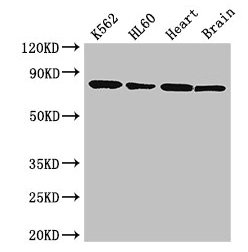 BTK Antibody - Western Blot Positive WB detected in: K562 whole cell lysate, HL60 whole cell lysate, Mouse heart tissue, Mouse brain tissue All lanes: BTK antibody at 3.5µg/ml Secondary Goat polyclonal to rabbit IgG at 1/50000 dilution Predicted band size: 77, 80 kDa Observed band size: 77 kDa