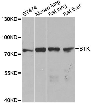 BTK Antibody - Western blot analysis of extracts of various cell lines, using BTK antibody at 1:1000 dilution. The secondary antibody used was an HRP Goat Anti-Rabbit IgG (H+L) at 1:10000 dilution. Lysates were loaded 25ug per lane and 3% nonfat dry milk in TBST was used for blocking. An ECL Kit was used for detection and the exposure time was 1s.