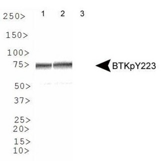 BTK Antibody - Western Blot: BTK [p Tyr223] Antibody - WB analysis of BTKpY223 with peptide competition: 1. ab only, 2. 200 molar excess unmodified immunizing peptide and 3. 200 molar excess modified immunizing peptide.  This image was taken for the unconjugated form of this product. Other forms have not been tested.
