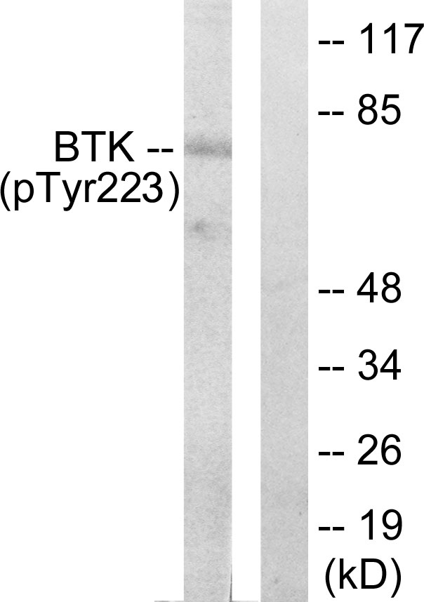 BTK Antibody - Western blot analysis of lysates from HeLa cells treated with Serum 10% 15', using BTK (Phospho-Tyr223) Antibody. The lane on the right is blocked with the phospho peptide.