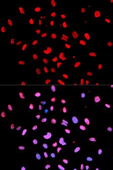 BTK Antibody - Immunofluorescence analysis of U2OS cells.