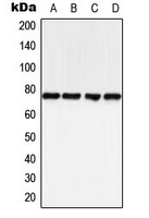 BTK Antibody - Western blot analysis of BTK (pY223) expression in DLD (A); mouse liver (B); rat liver (C); rat kidney (D) whole cell lysates.