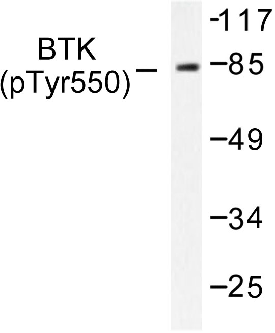 BTK Antibody - Western blot of p-Btk (Y551) pAb in extracts from HeLa cells.