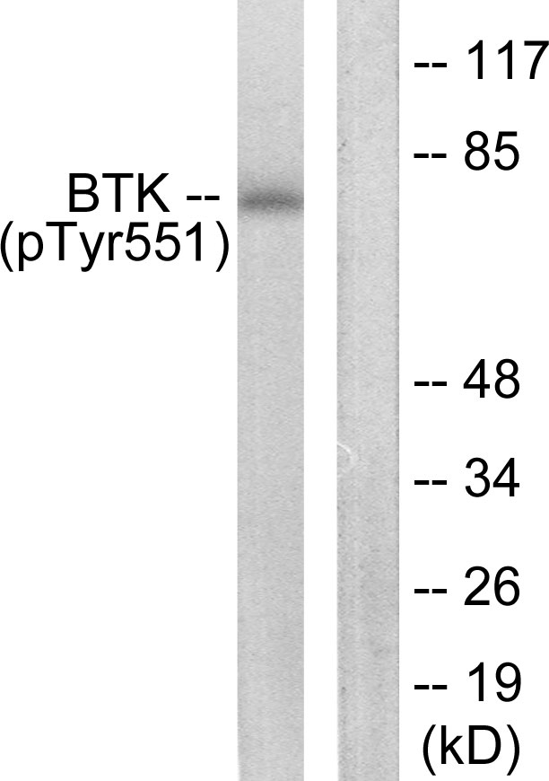 BTK Antibody - Western blot analysis of lysates from HeLa cells treated with H2O2 100uM 30', using BTK (Phospho-Tyr551) Antibody. The lane on the right is blocked with the phospho peptide.