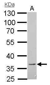 BTLA / CD272 Antibody - CD272 antibody detects BTLA protein by Western blot analysis. A. 30 ug A375 whole cell lysate/extract. 10 % SDS-PAGE. CD272 antibody dilution:1:1000