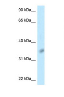 BTLA / CD272 Antibody - BTLA / CD272 antibody Western blot of Jurkat Cell lysate. Antibody concentration 1 ug/ml.  This image was taken for the unconjugated form of this product. Other forms have not been tested.