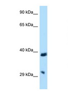 BTLA / CD272 Antibody - BTLA / CD272 antibody Western blot of HepG2 Cell lysate. Antibody concentration 1 ug/ml.  This image was taken for the unconjugated form of this product. Other forms have not been tested.