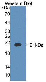 BTLA / CD272 Antibody - Western blot of BTLA / CD272 antibody.