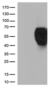 BTLA / CD272 Antibody - HEK293T cells were transfected with the pCMV6-ENTRY control. (Left lane) or pCMV6-ENTRY BTLA. (Right lane) cDNA for 48 hrs and lysed