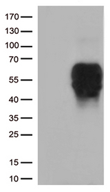 BTLA / CD272 Antibody - HEK293T cells were transfected with the pCMV6-ENTRY control. (Left lane) or pCMV6-ENTRY BTLA. (Right lane) cDNA for 48 hrs and lysed