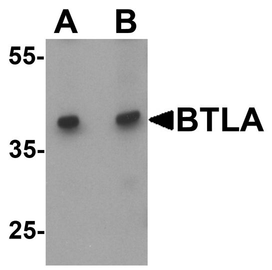 BTLA / CD272 Antibody - Western blot analysis of BTLA in Jurkat cell lysate at (A) 1 and (B) 2 ug/ml.