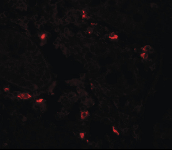 BTLA / CD272 Antibody - Immunofluorescence of BTLA in human small intestine tissue with BTLA antibody at 20 ug/ml.