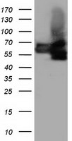 BTN1A1 Antibody - HEK293T cells were transfected with the pCMV6-ENTRY control (Left lane) or pCMV6-ENTRY BTN1A1 (Right lane) cDNA for 48 hrs and lysed. Equivalent amounts of cell lysates (5 ug per lane) were separated by SDS-PAGE and immunoblotted with anti-BTN1A1.