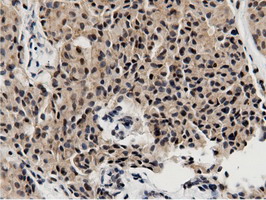 BTN1A1 Antibody - Immunohistochemical staining of paraffin-embedded Human colon tissue using anti-BTN1A1 mouse monoclonal antibody.