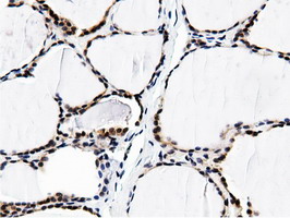 BTN1A1 Antibody - Immunohistochemical staining of paraffin-embedded Human thyroid tissue using anti-BTN1A1 mouse monoclonal antibody.