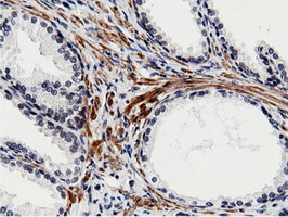 BTN1A1 Antibody - Immunohistochemical staining of paraffin-embedded Human prostate tissue using anti-BTN1A1 mouse monoclonal antibody.