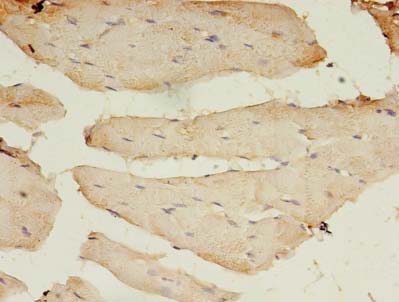 BTN2A1 Antibody - Immunohistochemistry of paraffin-embedded human Skeletal muscle using antibody at dilution of 1:100.