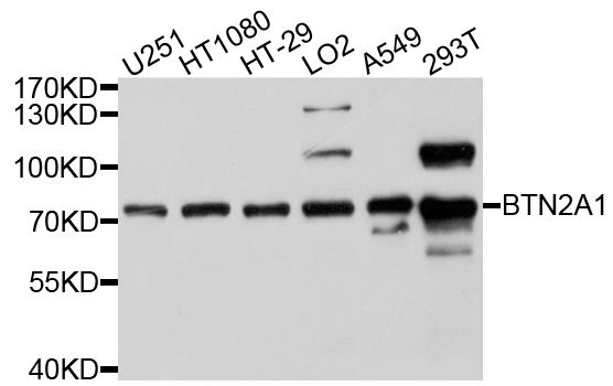 BTN2A1 Antibody - Western blot analysis of extracts of various cell lines, using BTN2A1 antibody at 1:1000 dilution. The secondary antibody used was an HRP Goat Anti-Rabbit IgG (H+L) at 1:10000 dilution. Lysates were loaded 25ug per lane and 3% nonfat dry milk in TBST was used for blocking. An ECL Kit was used for detection and the exposure time was 10s.
