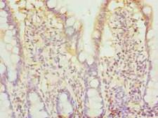 BTN2A2 Antibody - Immunohistochemistry of paraffin-embedded human small intestine tissue using BTN2A2 Antibody at dilution of 1:100