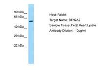 BTN2A2 Antibody -  This image was taken for the unconjugated form of this product. Other forms have not been tested.