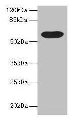 BTN3A1 / CD277 Antibody - Western blot All lanes: BTN3A1 antibody at 12µg/ml + Mouse liver tissue Secondary Goat polyclonal to rabbit IgG at 1/10000 dilution Predicted band size: 58, 40, 42, 53 kDa Observed band size: 58 kDa