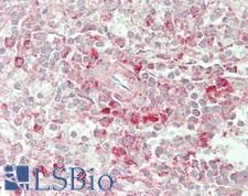 BTN3A2 Antibody - Human Spleen: Formalin-Fixed, Paraffin-Embedded (FFPE)