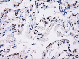 BTN3A2 Antibody - IHC of paraffin-embedded lung tissue using anti-BTN3A2 mouse monoclonal antibody. (Dilution 1:50).