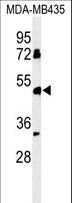 BTNL8 Antibody - Western blot of BTNL8 Antibody in MDA-MB435 cell line lysates (35 ug/lane). BTNL8 (arrow) was detected using the purified antibody.