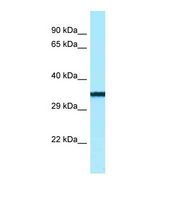 BTNL9 Antibody - Western blot of Human Jurkat. BTNL9 antibody dilution 1.0 ug/ml.  This image was taken for the unconjugated form of this product. Other forms have not been tested.