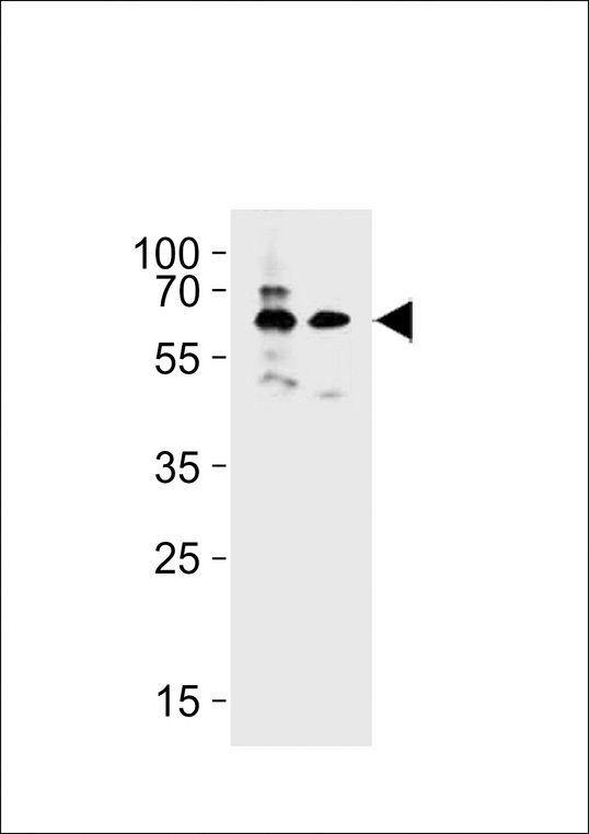 BTRCP / BETA-TRCP Antibody - BRTC1/2 Antibody western blot of MDA-MB453,HepG2 cell line lysates (35 ug/lane). The BRTC1/2 antibody detected the BRTC1/2 protein (arrow).