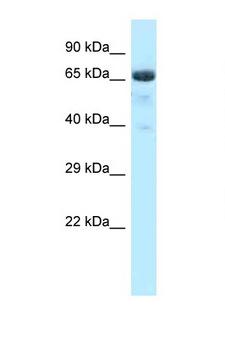 BTRCP / BETA-TRCP Antibody - BTRC / bTrCP antibody western blot of Rat Lung lysate. Antibody concentration 1 ug/ml.  This image was taken for the unconjugated form of this product. Other forms have not been tested.