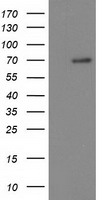 BTRCP / BETA-TRCP Antibody - HEK293T cells were transfected with the pCMV6-ENTRY control (Left lane) or pCMV6-ENTRY BTRC (Right lane) cDNA for 48 hrs and lysed. Equivalent amounts of cell lysates (5 ug per lane) were separated by SDS-PAGE and immunoblotted with anti-BTRC.