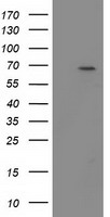 BTRCP / BETA-TRCP Antibody - HEK293T cells were transfected with the pCMV6-ENTRY control (Left lane) or pCMV6-ENTRY BTRC (Right lane) cDNA for 48 hrs and lysed. Equivalent amounts of cell lysates (5 ug per lane) were separated by SDS-PAGE and immunoblotted with anti-BTRC.
