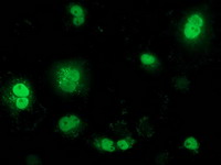 BTRCP / BETA-TRCP Antibody - Anti-BTRC mouse monoclonal antibody immunofluorescent staining of COS7 cells transiently transfected by pCMV6-ENTRY BTRC.