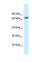BTRCP / BETA-TRCP Antibody - BTRC / bTrCP antibody Western blot of Mouse Pancreas lysate. Antibody concentration 1 ug/ml.  This image was taken for the unconjugated form of this product. Other forms have not been tested.