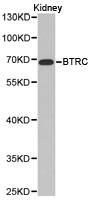 BTRCP / BETA-TRCP Antibody - Western blot of extracts of Kidney cell line, using BTRC antibody.
