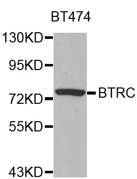 BTRCP / BETA-TRCP Antibody - Western blot analysis of extracts of BT474 cell line, using BTRC antibody.