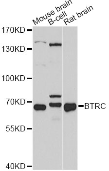 BTRCP / BETA-TRCP Antibody - Western blot analysis of extracts of various cell lines, using BTRC antibody at 1:1000 dilution. The secondary antibody used was an HRP Goat Anti-Rabbit IgG (H+L) at 1:10000 dilution. Lysates were loaded 25ug per lane and 3% nonfat dry milk in TBST was used for blocking. An ECL Kit was used for detection and the exposure time was 60s.