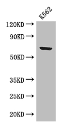 BTRCP / BETA-TRCP Antibody - Positive WB detected in:K562 whole cell lysate;All lanes: BTRC antibody at 2.8ug/ml;Secondary;Goat polyclonal to rabbit IgG at 1/50000 dilution;Predicted band size: 69,66 kDa;Observed band size: 69 kDa;