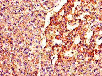 BTRCP / BETA-TRCP Antibody - Immunohistochemistry of paraffin-embedded human pancreatic tissue using BTRC Antibody at dilution of 1:100