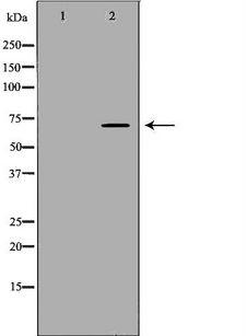 BTRCP / BETA-TRCP Antibody - Western blot analysis of extracts of Kidney using BTRC antibody. The lane on the left is treated with the antigen-specific peptide.