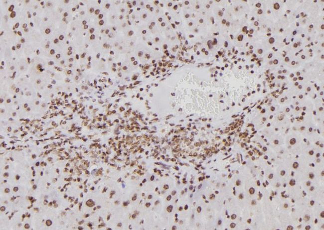 BTRCP / BETA-TRCP Antibody - 1:100 staining mouse liver tissue by IHC-P. The sample was formaldehyde fixed and a heat mediated antigen retrieval step in citrate buffer was performed. The sample was then blocked and incubated with the antibody for 1.5 hours at 22°C. An HRP conjugated goat anti-rabbit antibody was used as the secondary.