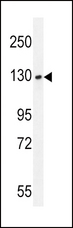 BUB1 Antibody - BUB1A Antibody (F1058) western blot of T47D cell line lysates (35 ug/lane). The BUB1A antibody detected the BUB1A protein (arrow).