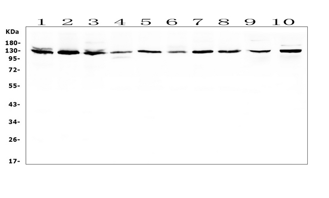 BUB1 Antibody - Western blot analysis of BUB1 using anti-BUB1 antibody. Electrophoresis was performed on a 5-20% SDS-PAGE gel at 70V (Stacking gel) / 90V (Resolving gel) for 2-3 hours. The sample well of each lane was loaded with 50ug of sample under reducing conditions. Lane 1: human K562 whole cell lysates, Lane 2: human Hela whole cell lysates, Lane 3: human 293T whole cell lysates, Lane 4: human A431 whole cell lysates, Lane 5: human Caco-2 whole cell lysates, Lane 6: human PC-3 whole cell lysates, Lane 7: human MCF-7 whole cell lysates, Lane 8: human U2OS whole cell lysates, Lane 9: rat testis tissue lysates, Lane 10: mouse testis tissue lysates. After Electrophoresis, proteins were transferred to a Nitrocellulose membrane at 150mA for 50-90 minutes. Blocked the membrane with 5% Non-fat Milk/ TBS for 1.5 hour at RT. The membrane was incubated with rabbit anti-BUB1 antigen affinity purified polyclonal antibody at 0.5 µg/mL overnight at 4°C, then washed with TBS-0.1% Tween 3 times with 5 minutes each and probed with a goat anti-rabbit IgG-HRP secondary antibody at a dilution of 1:10000 for 1.5 hour at RT. The signal is developed using an Enhanced Chemiluminescent detection (ECL) kit with Tanon 5200 system. A specific band was detected for BUB1 at approximately 130KD. The expected band size for BUB1 is at 122KD.