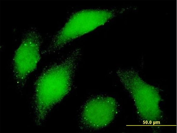 BUB1 Antibody - Immunofluorescence of monoclonal antibody to BUB1 on HeLa cell . [antibody concentration 10 ug/ml]