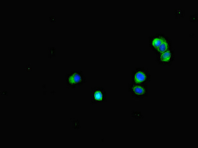 BUB1B / BubR1 Antibody - Immunofluorescent analysis of HepG2 cells diluted at 1:100 and Alexa Fluor 488-congugated AffiniPure Goat Anti-Rabbit IgG(H+L)