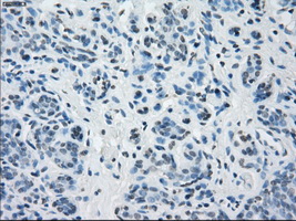 BUB1B / BubR1 Antibody - IHC of paraffin-embedded breast tissue using anti-BUB1B mouse monoclonal antibody. (Dilution 1:50).