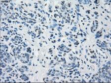 BUB1B / BubR1 Antibody - IHC of paraffin-embedded breast tissue using anti-BUB1B mouse monoclonal antibody. (Dilution 1:50).